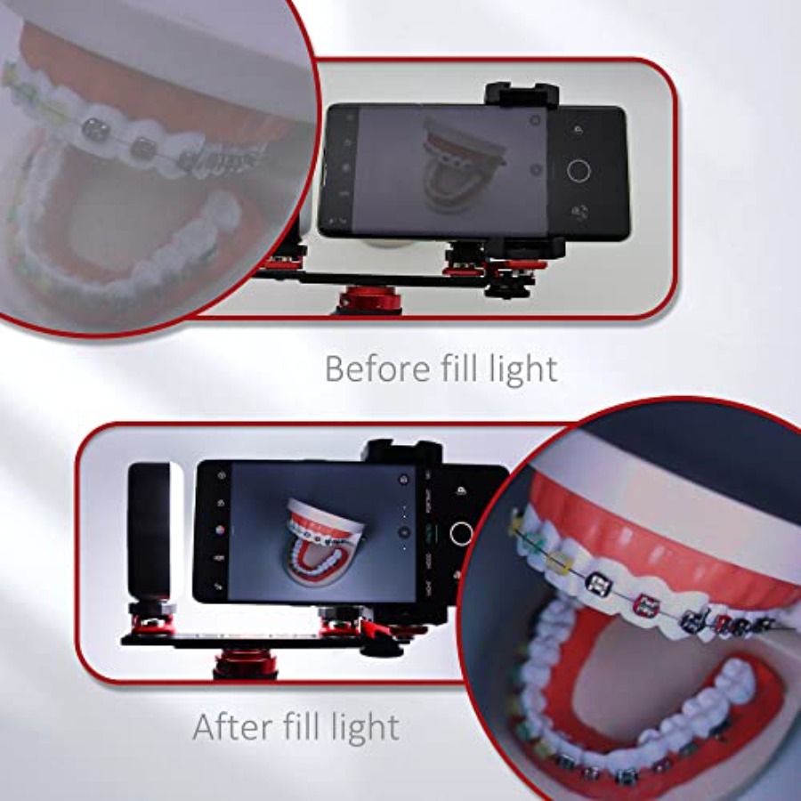 Bluetooth Dental Flash Light P – обзор и цена Photography Lighting Flash