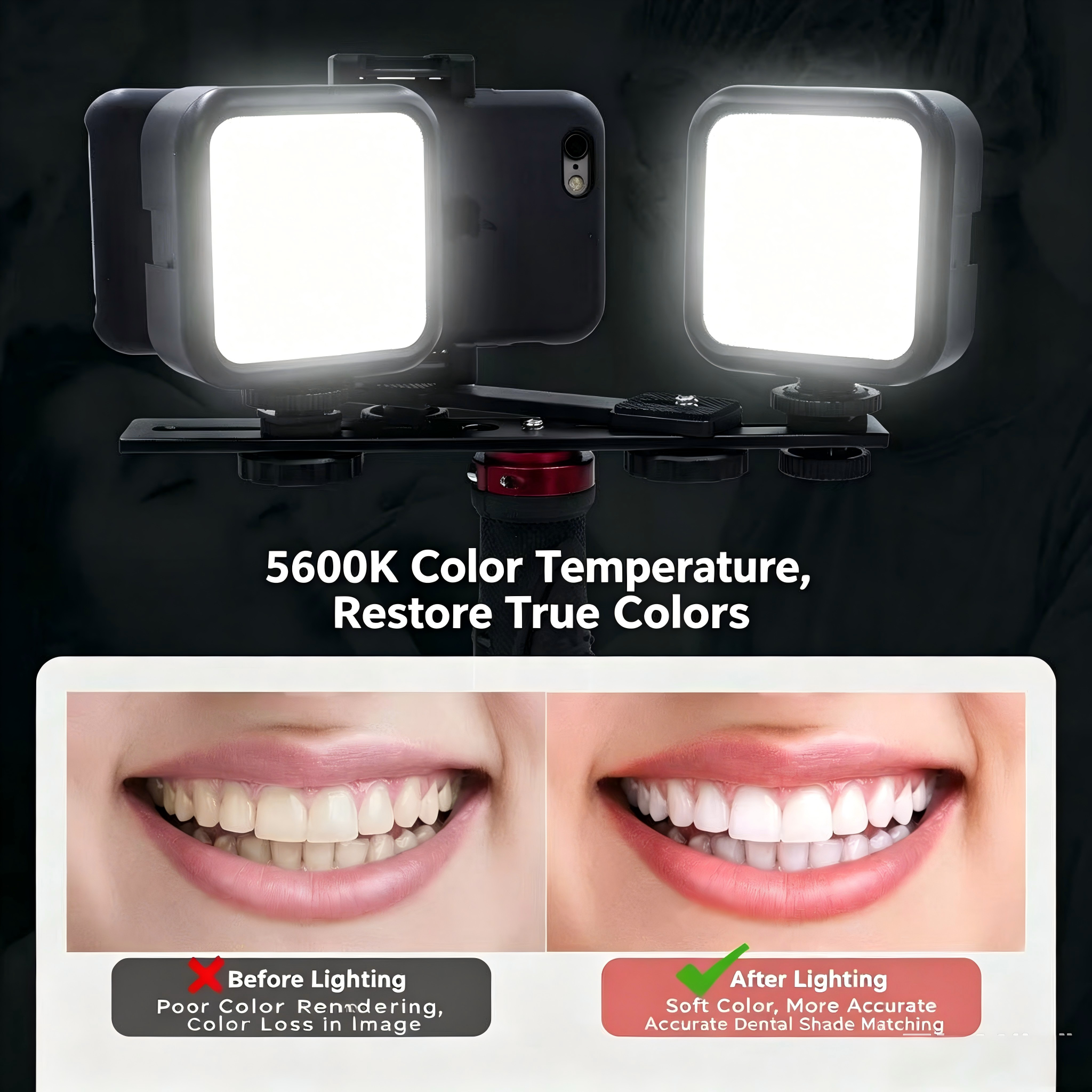 Portable Dental Photography Li – обзор и цена Photography Lighting Definition