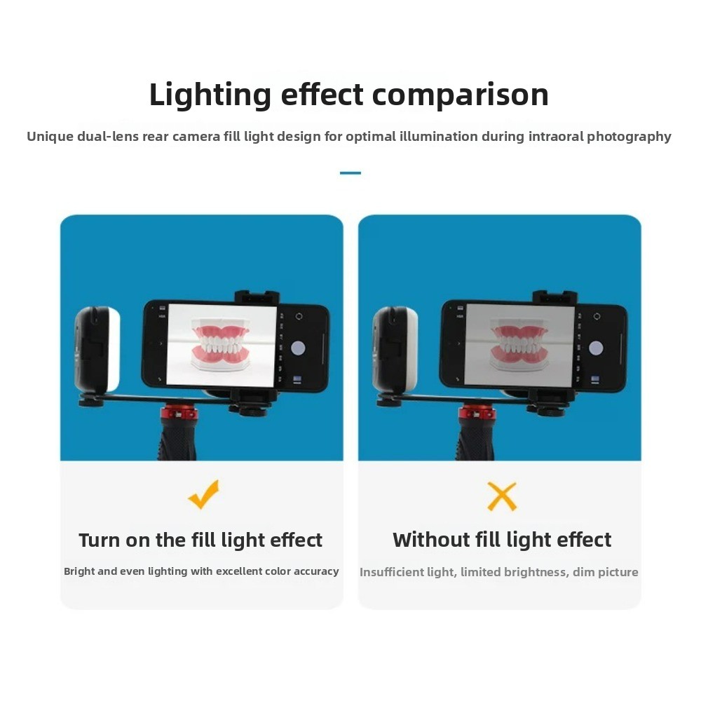 Dental Photography Light, Blue – обзор и цена Photography Lighting Flash
